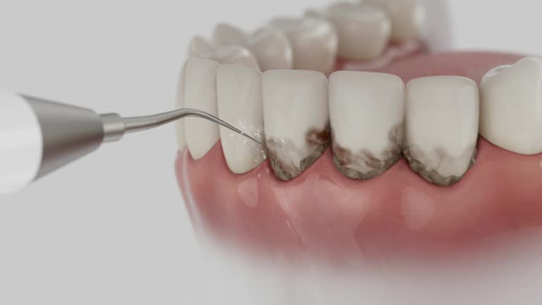 Reliable Root Canal Treatment contractor in Lafourche Parish County, LA by Dentist Open Now